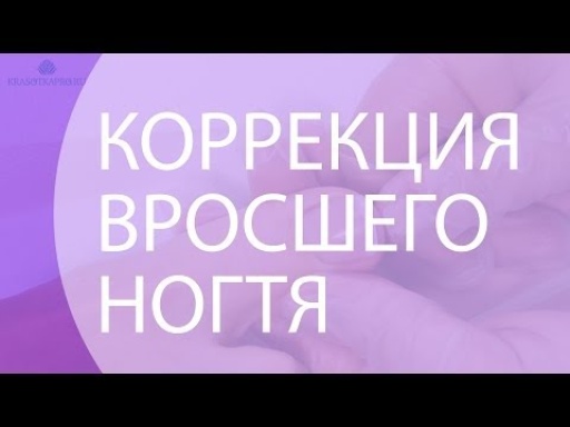 Коррекция вросшего ногтя (инструкция)